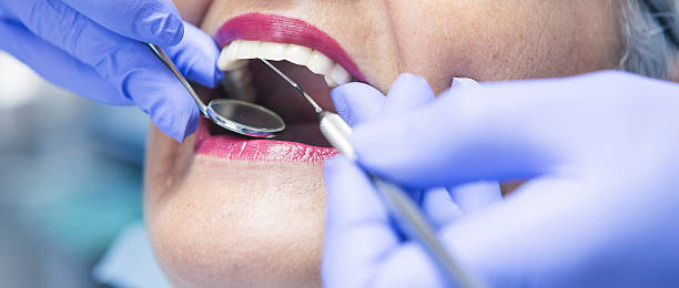 Best Emergency Dental Extractions in Woodville, FL